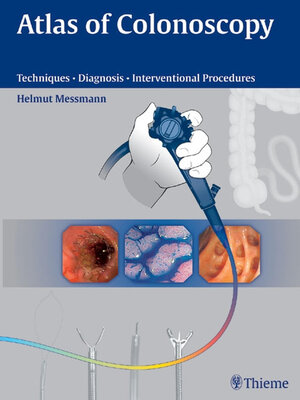 cover image of Atlas of Colonoscopy